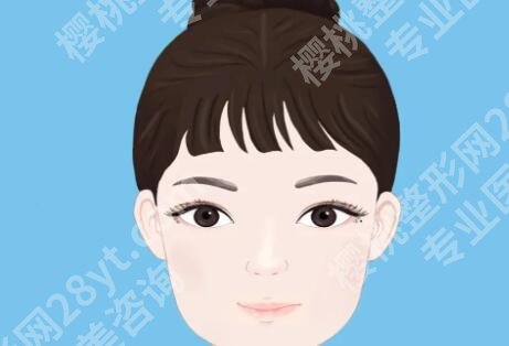 上海丁志双眼皮费用多少？全切双眼皮5139元起
