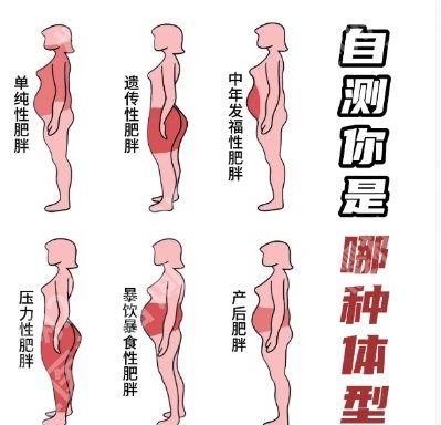 南京美莱整形案例图鉴赏！腹部吸脂恢复的很好，技术赞、服务好~