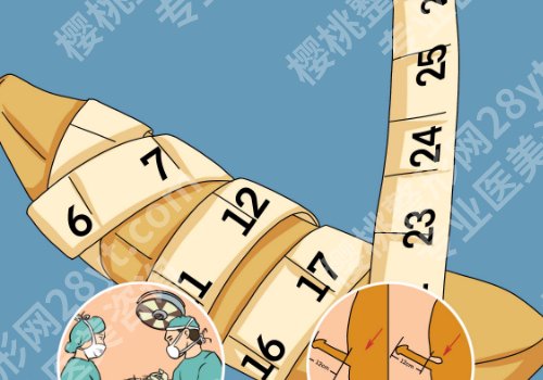 2025成都增长增粗医院排名更新！九龙、恒博、中医一附院上榜