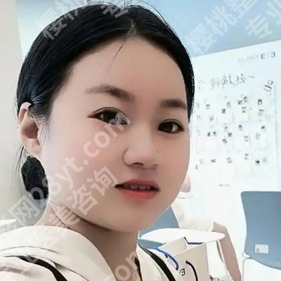 广州人民医院做双眼皮好吗？附医院介绍、技术特色！