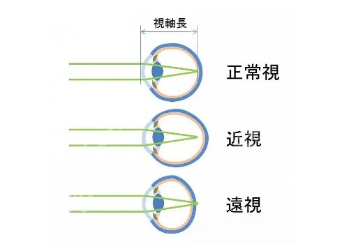广州华侨医院近视激光怎么样？顾客口碑、科室详情更新！