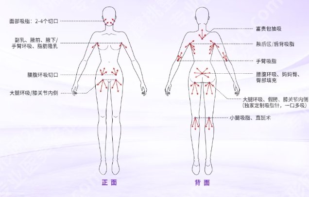 华西医院富贵包手术多少钱？贵不贵？收费明细一览！