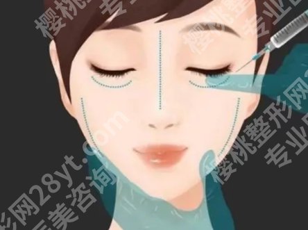 上海九院哪个医生取注射物好？医生团队资源分享！