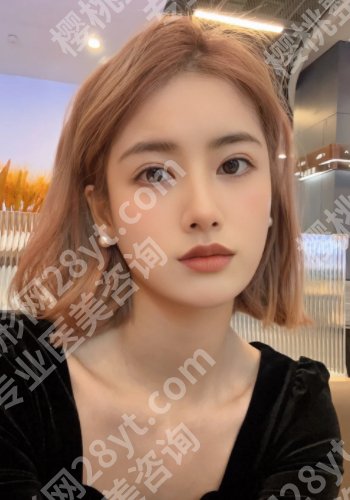 李圣利做双眼皮价格多少？低至6000元起！医生实力在线！