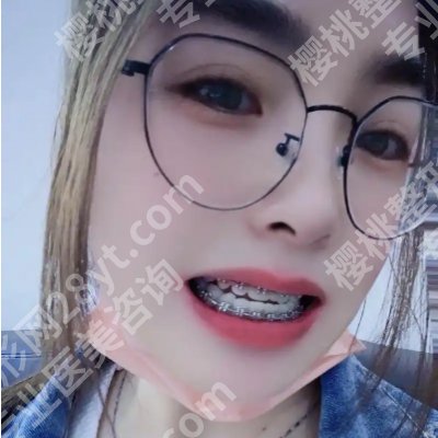 2025上海华东医院牙齿矫正价格高吗？低至5000元起！附医院资料！