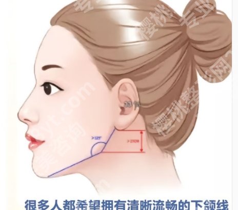 深圳北大医院磨骨手术费用贵不贵？医院口碑测评|案例鉴赏！
