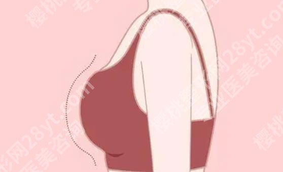上海第九人民医院隆胸哪个医生好？王涛、何金光、俞哲元等技术不错！
