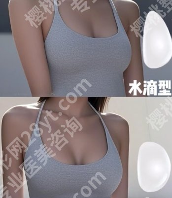 山东省立医院脂肪丰胸怎么样？戳进来看真实的案例吧！