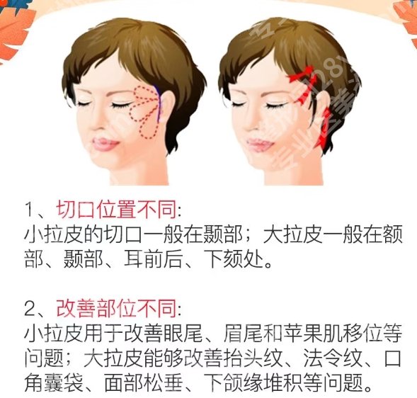 黄寺杜太超小切口拉皮技术好吗？附顾客口碑点评！收藏再看！