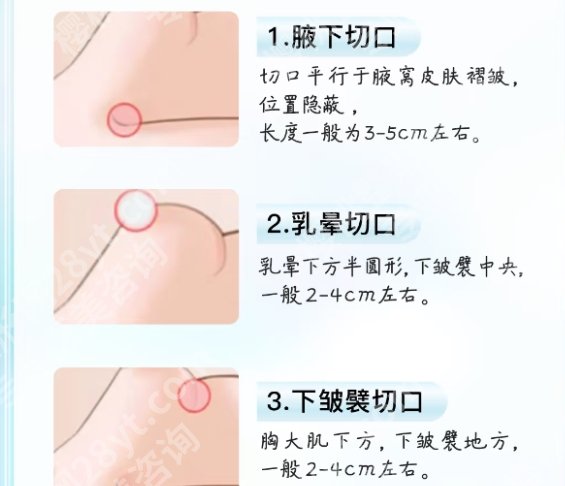北京美莱做胸好的医生:赵志力\曾昂实力不凡，技术各有特色！附价格