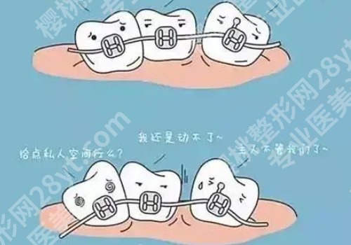 2025中山三院矫牙费用是多少？低至于11000元起，科室详情简介曝光！