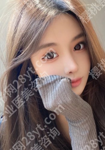 广州武警医院割双眼皮多少钱？低至6200元起！好评如潮！