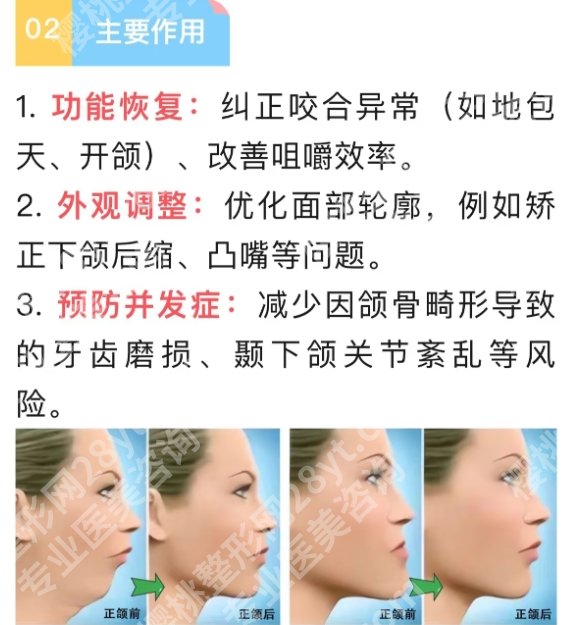 海淀医院正颌手术费用曝光！25年2.6万元起！专业医师团队介绍！