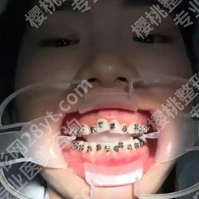佛山第一人民医院口腔科正畸记录怎么样？技术优势、医生资料更新！