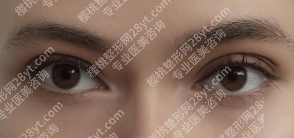 杭州浙一医院去眼袋多少钱？哪位医生做的好？去眼袋手术小课堂