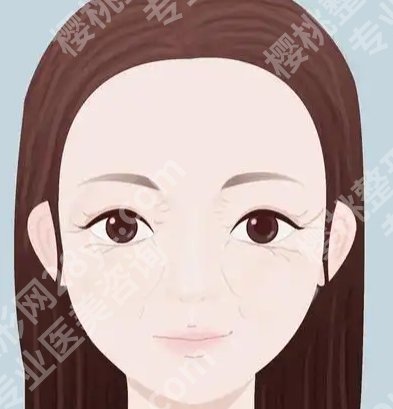 薇旖美打眼周细纹多久见效？常见问题和注意事项更新