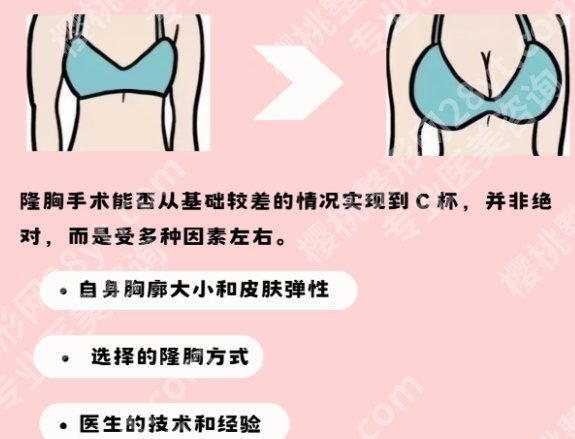 长沙隆胸医院排名前十榜单公布一览！院内基本信息详细介绍！
