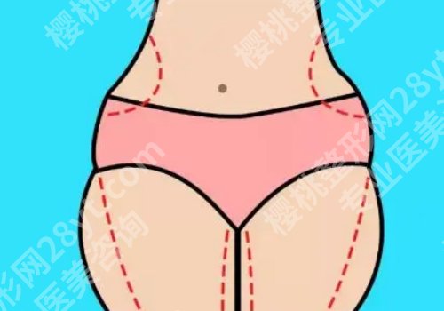 曾德浩医生在荔医做吸脂手术做的怎么样呢？技术精湛、审美独特、真实反馈！