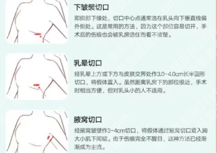 天津隆胸专家排行榜推荐！医生个人简历及医院背景相关介绍！
