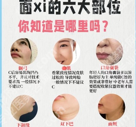 海淀医院面部吸脂多少钱?25年13650元起,性价比高、技术真的好!