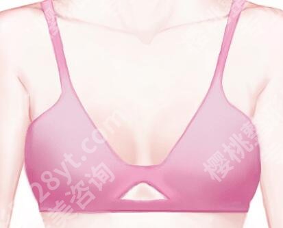 江苏省中医院丰胸怎么样？医院咨询和2025价格盘点