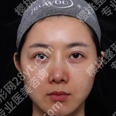 2025宁波第三医院祛斑多少钱?低至3000元起!附医院实力!