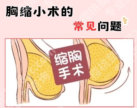 上海长征医院缩胸手术怎么样？医院简介|真人案例鉴赏！