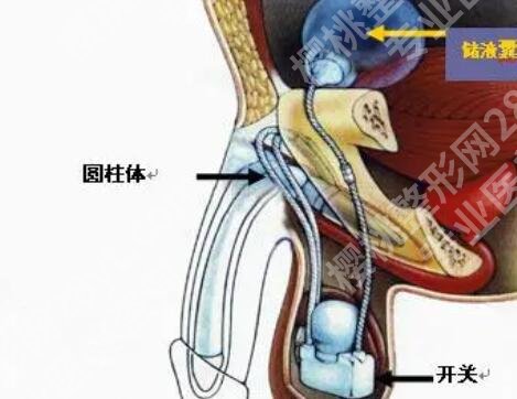男性增大增粗手术多少钱？推荐几家口碑好又实惠的医院！