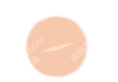 2025上海六院激光祛疤费用多少？低至3000元起，案例一览