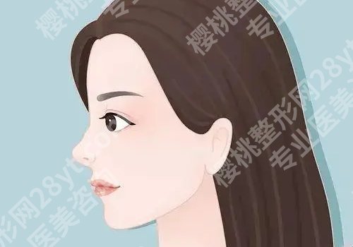 邵逸夫医院做鼻子怎么样？技术靠谱！口碑杠杠的！