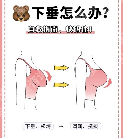 乌鲁木齐胸下垂矫正医院推荐！2025年口碑医院速速围观！