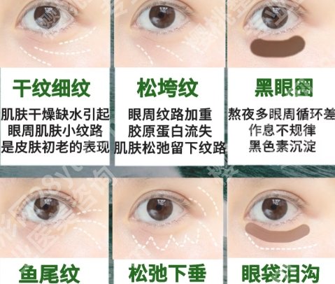 华西医院祛眼袋挂哪个科？整形外科！内附实力点评、专家名单！