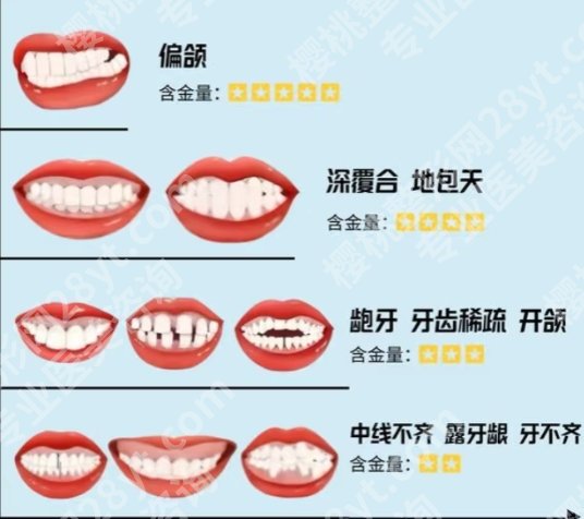 北京协和医院颌面外科哪个医生好？专家名单:赖钦声、周炼技术审美在线