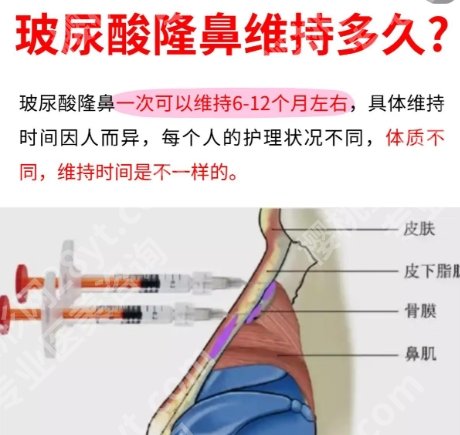 广州荔医整形美容怎么样？特色项目公布了
