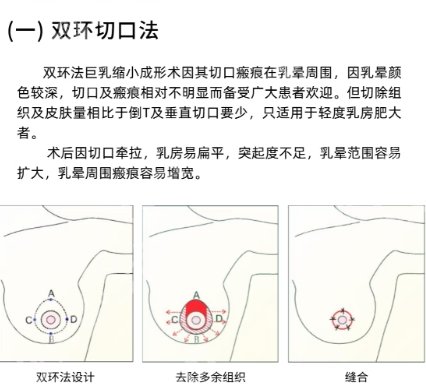 武汉三甲医院缩胸术不错的有哪几家？医院排行榜名单出炉！
