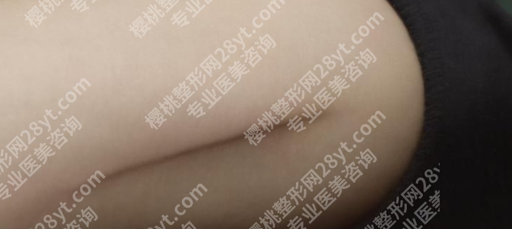 南京祛疤痕医院排行名单一览！维多利亚、康美等入围