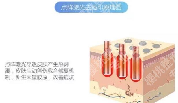 中山三院点阵激光收费表？医院简介