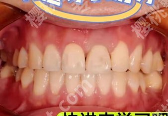 北京长庚医院牙科能种牙吗？医院特色项目查看