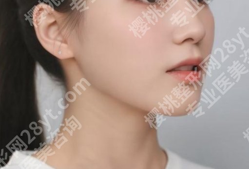 武汉中翰吴中兴下颌角手术怎么样？医生详情介绍