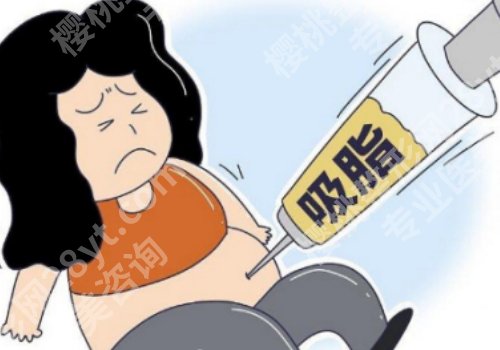 成都张寒吸脂怎么样？医院技术大牛、案例多曝光！