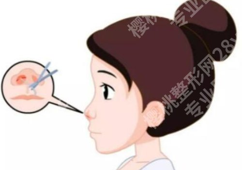北京黄大勇医生怎么样？审美技术双在线，附案例！