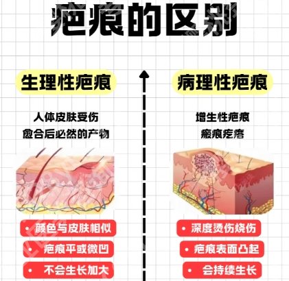泉州二院点阵激光技术怎么样？简介公布