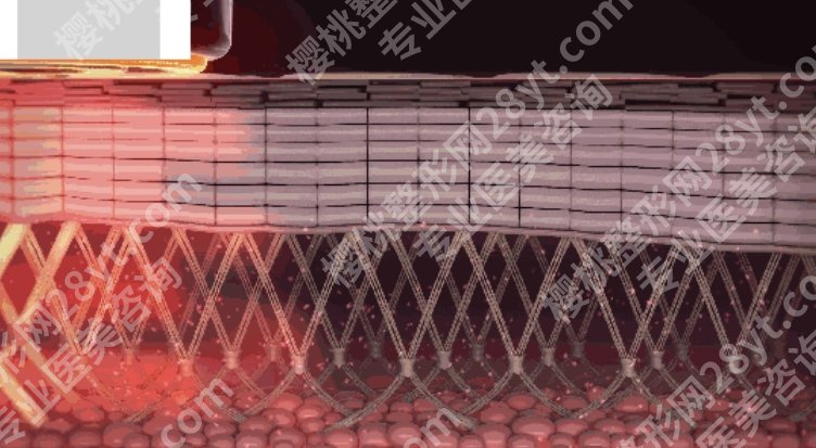 吉大一院热玛吉多少钱？去医院挂那个科？案例分析