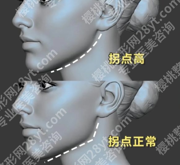 上海九院磨下颌骨多少钱？真实案例|见证TA的蜕变