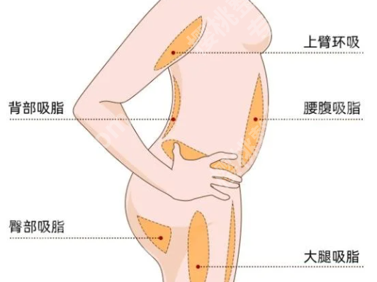 浙医二院腹壁整形专家有哪些？查看热门医生信息一览