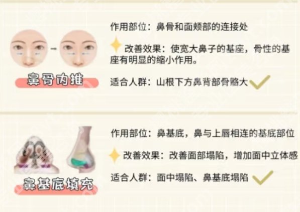北京301隆鼻多少钱?脂肪鼻2万元起、软肋骨3万元起...附25年价格明细
