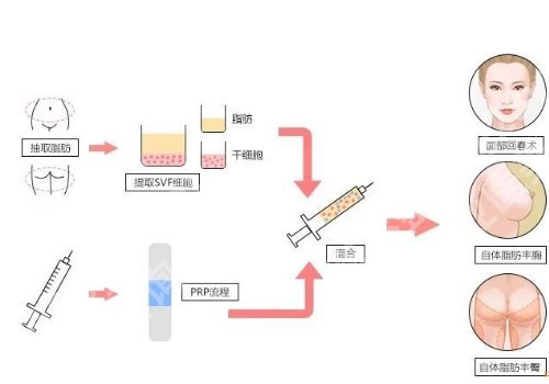 北京八大处脂肪填充怎么样？顾客口碑曝光！好评连连 ！