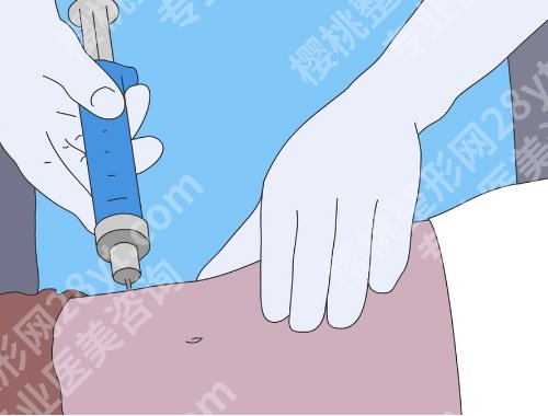 南京张让虎简历更新！医生实力怎么样？一篇文章告诉你！