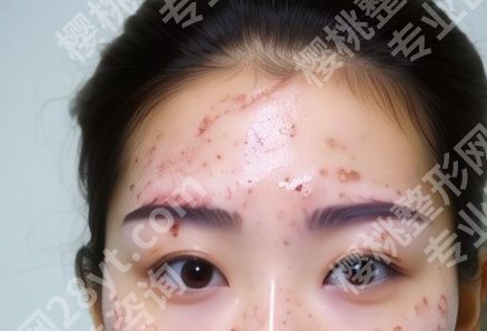 合肥激光祛斑医院排名分享了，一一看详情简介