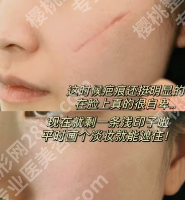 杭州祛疤痕医院排行，医院详情介绍